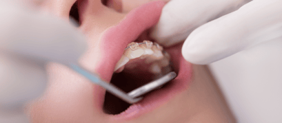 UCSLP articulo beneficios de la ortodoncia_3